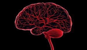 A detailed arteriogram of the brain, showing the major arteries and their branches with contrast dye flowing through, highlighting possible aneurysms.